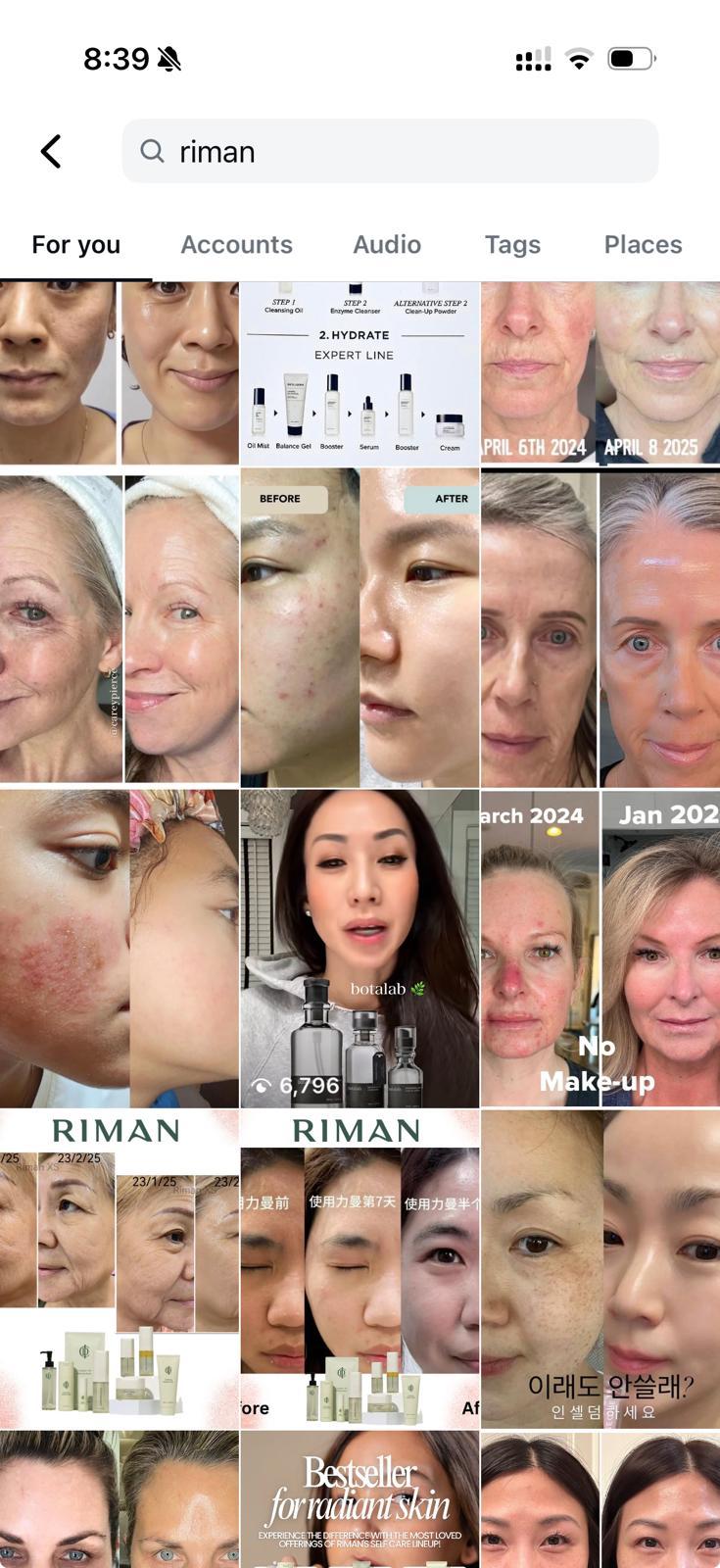 Riman before and after result